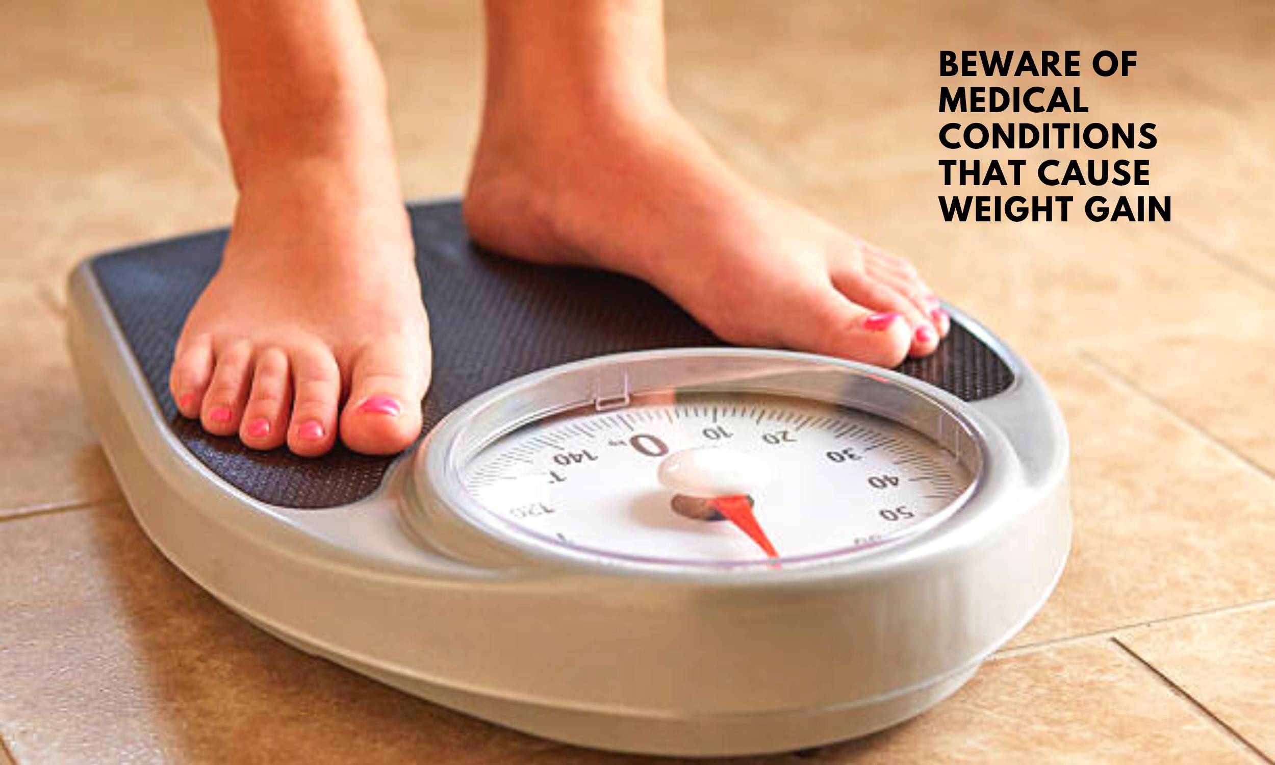 beware-of-medical-conditions-that-cause-weight-gain