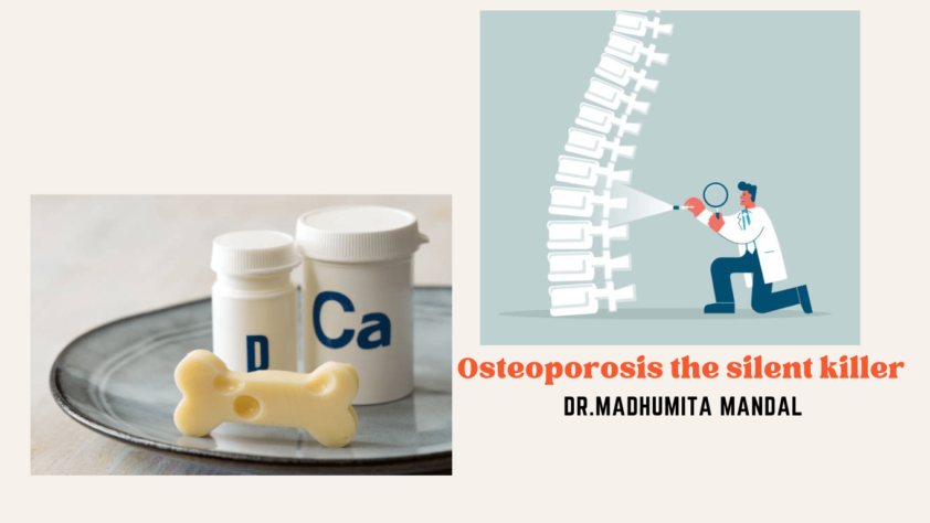 Osteoporosis is a silent killer
